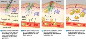 211-inflammatiion