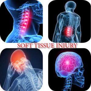 says-210 soft_tissue_injury